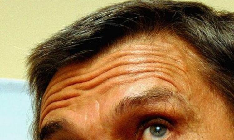 Морщины на лице у мужчин как избавиться Морщины на лице у мужчин как избавиться