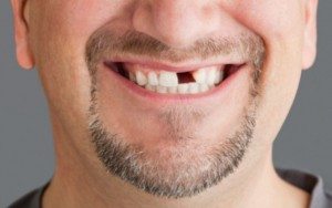 К чему снится выпадение зубов без крови и боли сонник