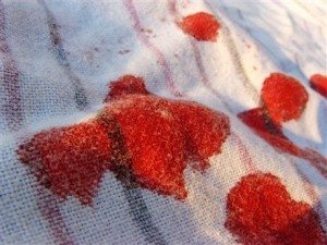 кровь на одежде