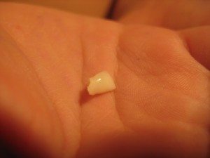 зуб на ладони