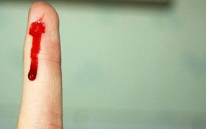 палец в крови