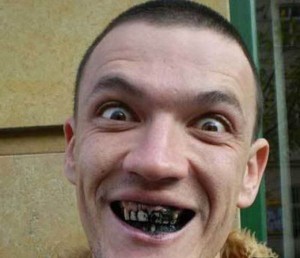 черные зубы у мужчины